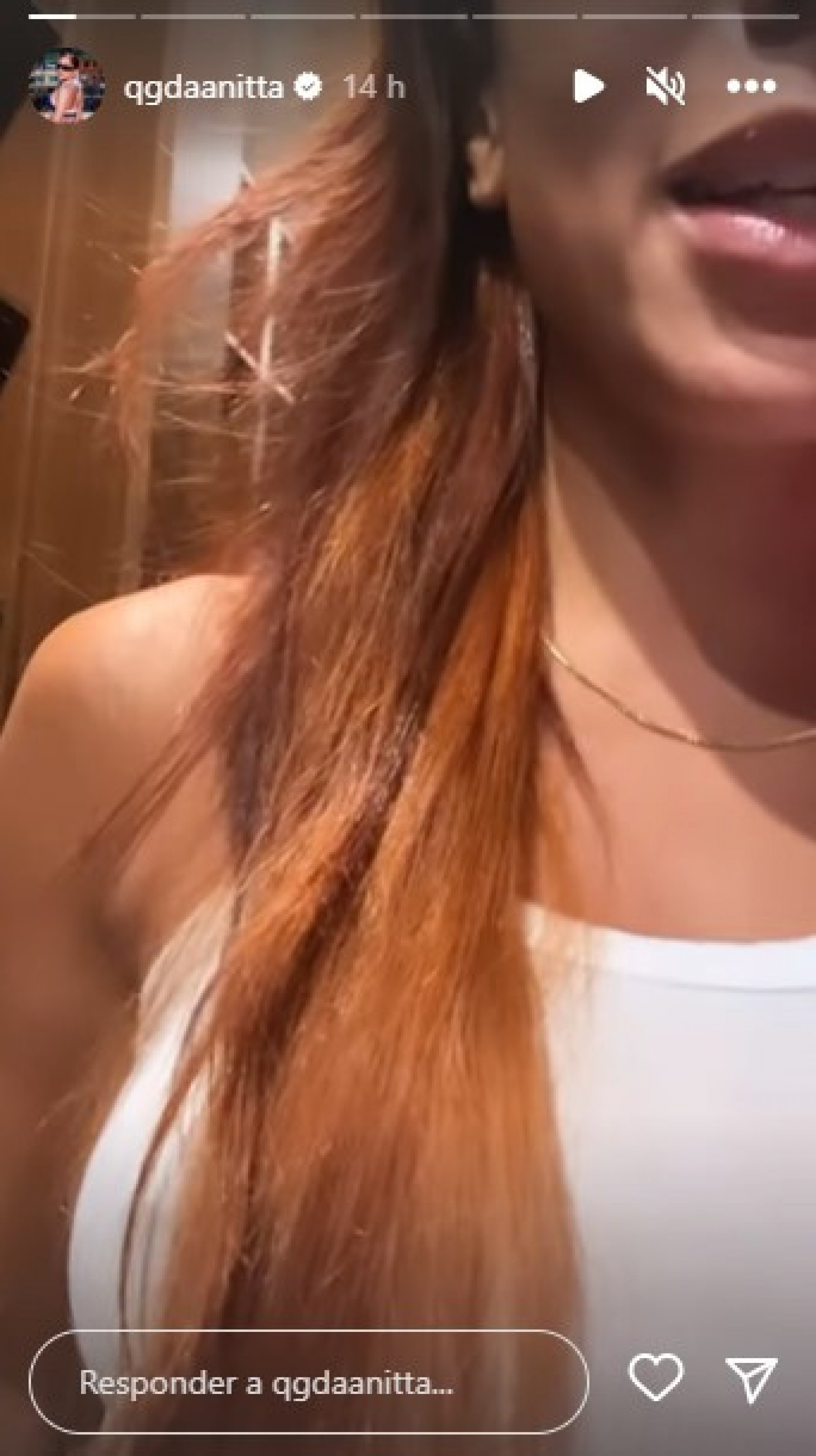 Anitta mostra procedimento incompleto no cabelo - Reprodução/Instagram