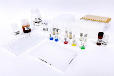 Fiocruz desenvolve kit que detecta sangue infectado com malária