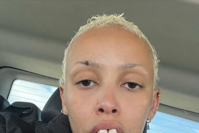 Após briga com fãs, Doja Cat perde mais de 250 mil seguidores