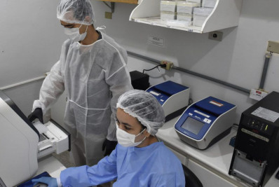 Pesquisadores da Fiocruz criam método para detectar hepatite D