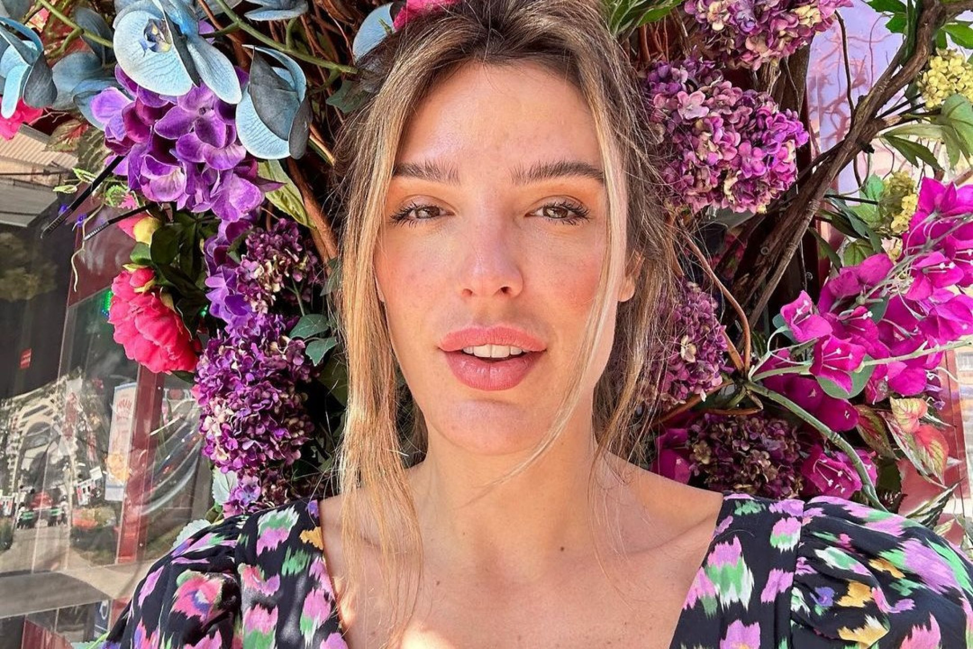 Rafa Brites comentou recuperação após retirada das próteses de silicone - Reprodução/Instagram