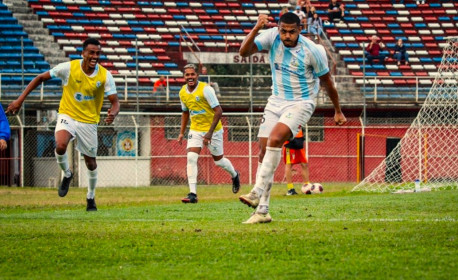 Duque de Caxias x SERRA MACAENSE AO VIVO | Cariocão B1