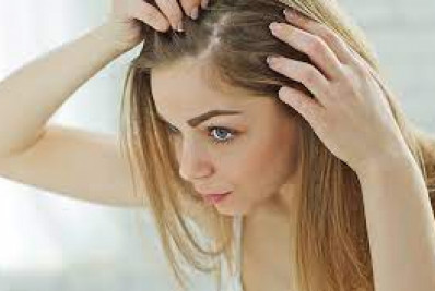 O inverno aumenta a caspa? Especialista explica!