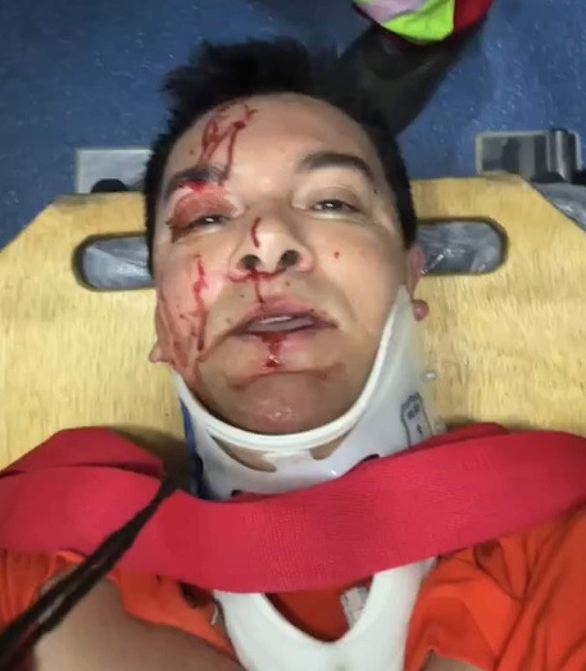 Regis Danese sofre acidente de carro em Goiás - Reprodução do Instagram