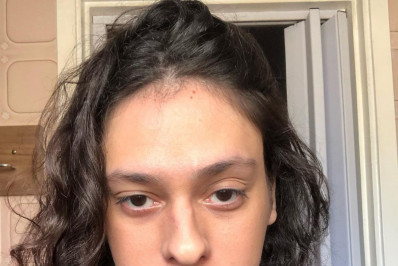 Victor Meyniel se pronuncia após ser espancado em ataque homofóbico: 'Nada será impune'