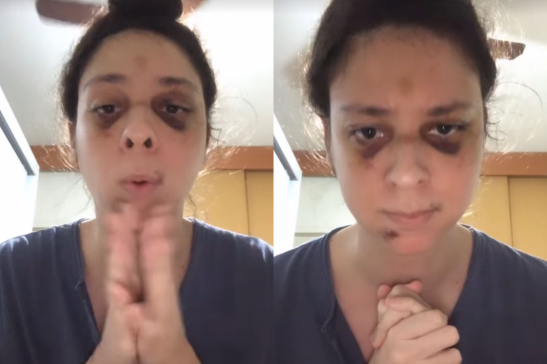 Victor Meyniel aparece pela primeira vez em sua rede social após ser agredido e agradece carinho - Reprodução / Instagram