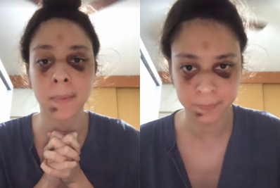 Victor Meyniel se pronuncia após ser espancado em ataque homofóbico: 'Nada será impune'