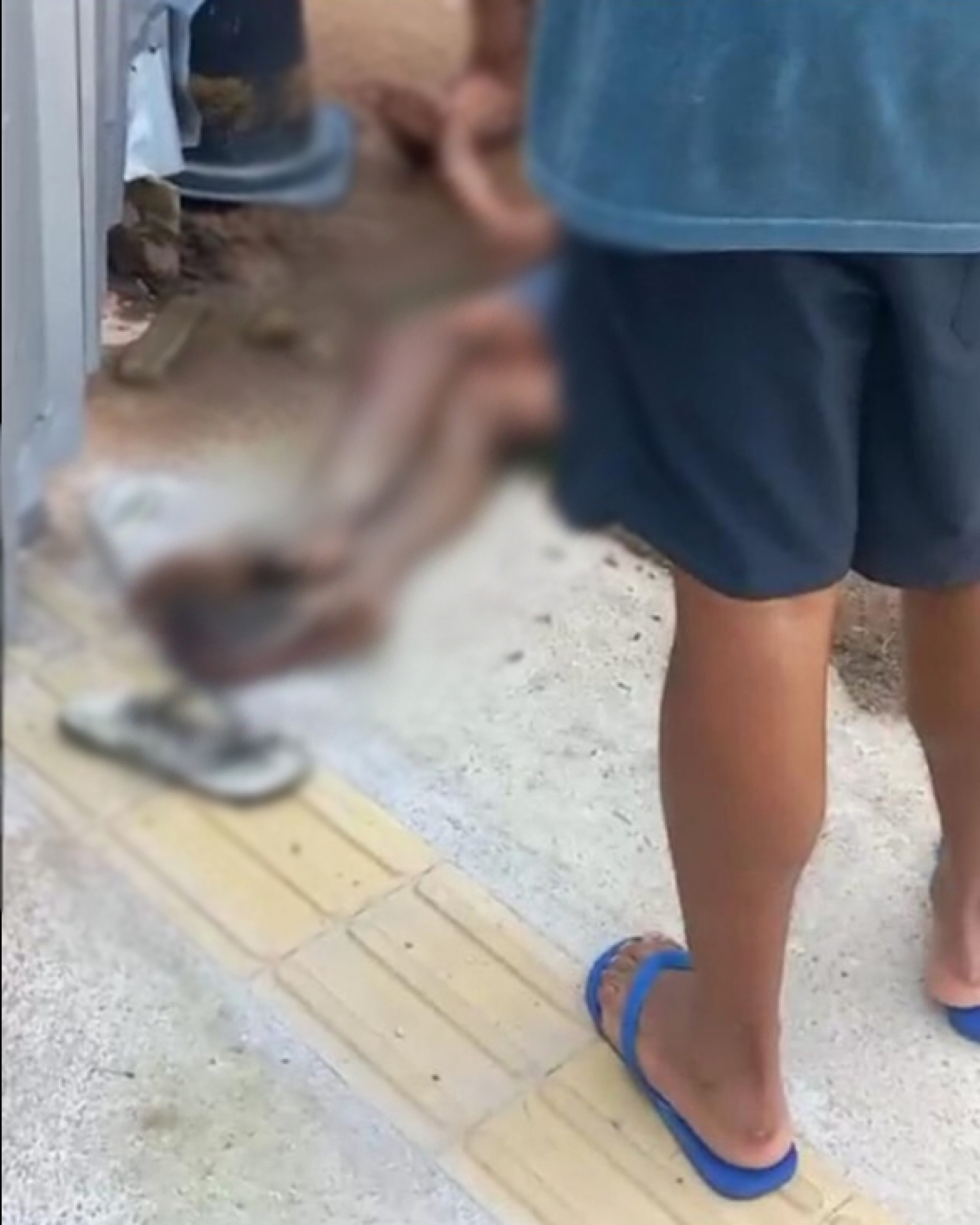 Menino está internado em estado grave com queimaduras de 3º grau