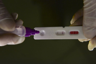 Número de casos de covid mais do que triplica na cidade de São Paulo