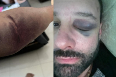 Cliente é espancado ao questionar conta do Buda Lounge, em Cabo Frio