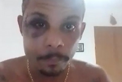 Polícia investiga agressão motivada por homofobia contra amigos na Zona Norte