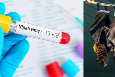 Nipah: veja como age o vírus que matou jovem na Índia e as chances de doença chegar ao Brasil