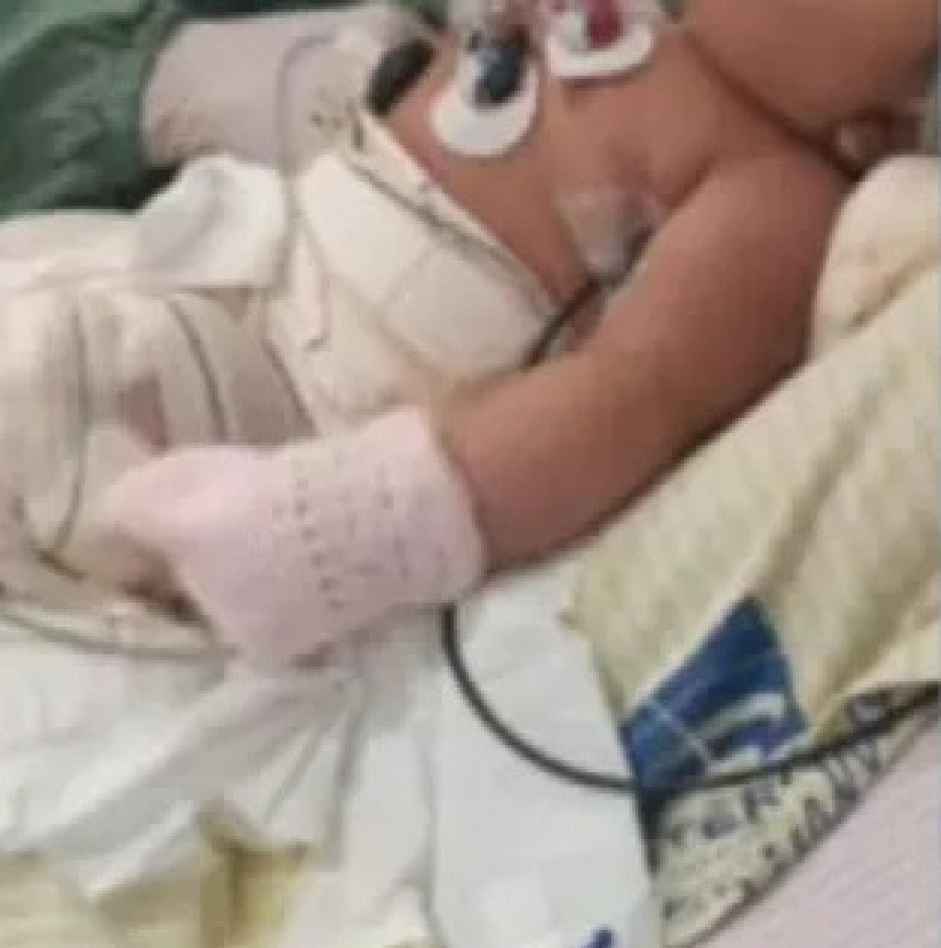 Bebê de sei meses morreu após ter o corpo queimado no Hospital Municipal Getúlio Vargas Filho, o Getulinho, em Niterói - Reprodução