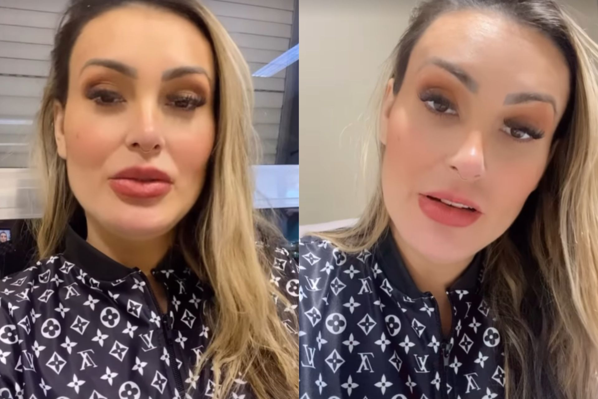 Andressa Urach passa por cirurgia de emergência - Reprodução / Instagram