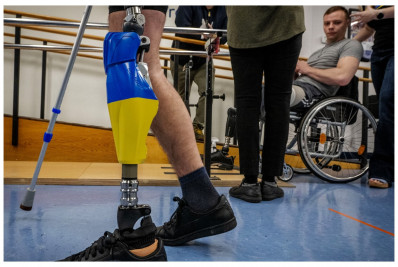 Mais de 20 mil ucranianos amputados enfrentam trauma em escala equivalente à da 1ª Guerra