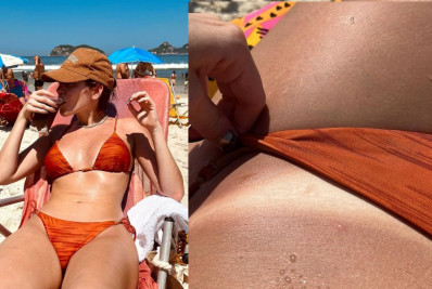 Ana Clara renova bronzeado em praia do Rio e exibe a marquinha; veja