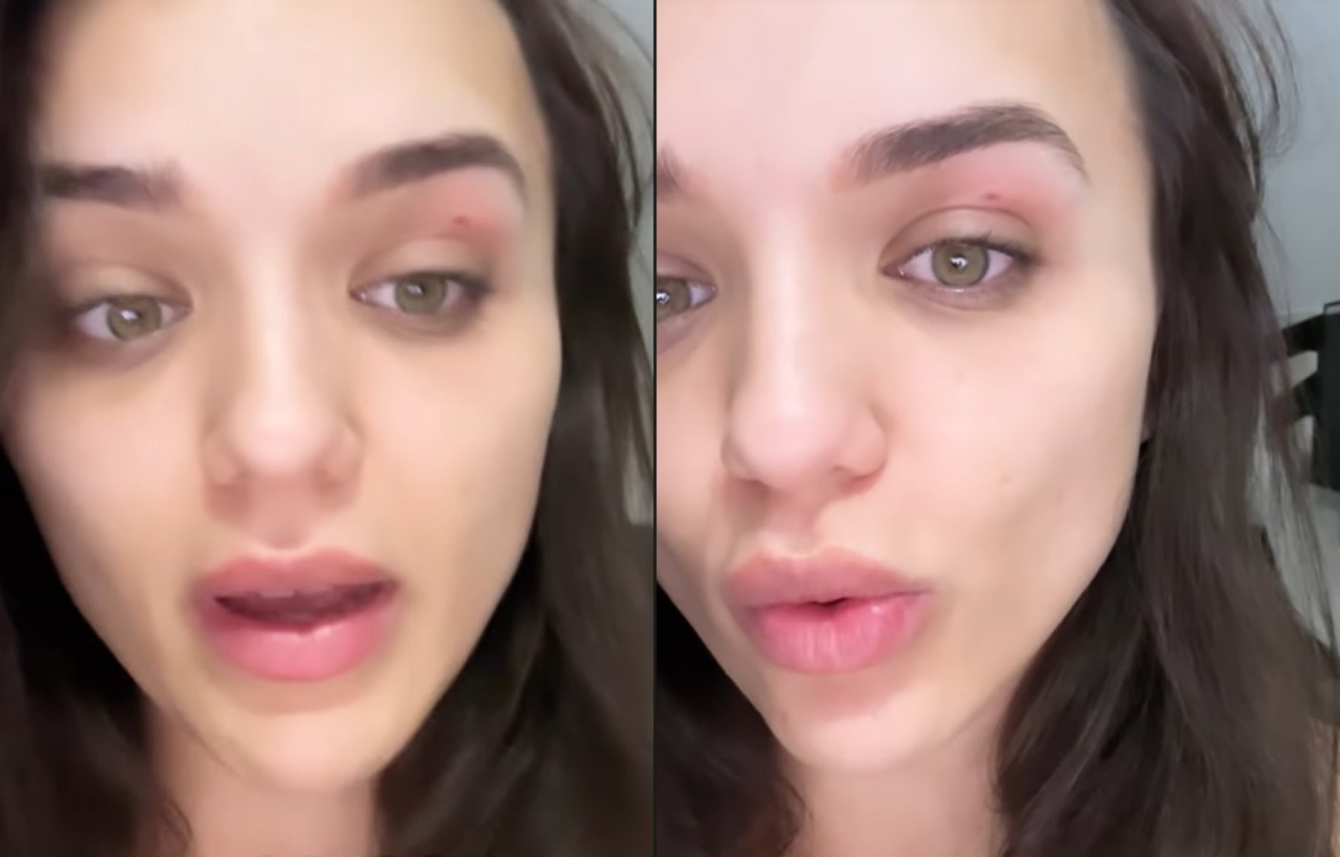 Rafa Kalimann mostra picada de abelha no olho - Reprodução do Instagram