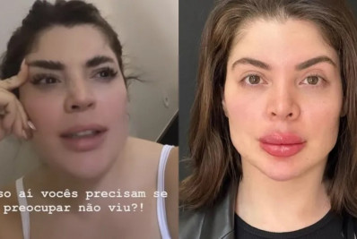 Gkay admite que se arrepende de ter feito harmonização facial: 'Não tinha ninguém para avisar?'