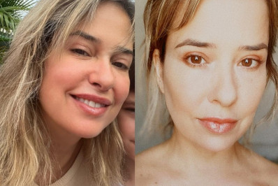 Após publicar foto com rosto inchado, Paloma Duarte rebate críticas
