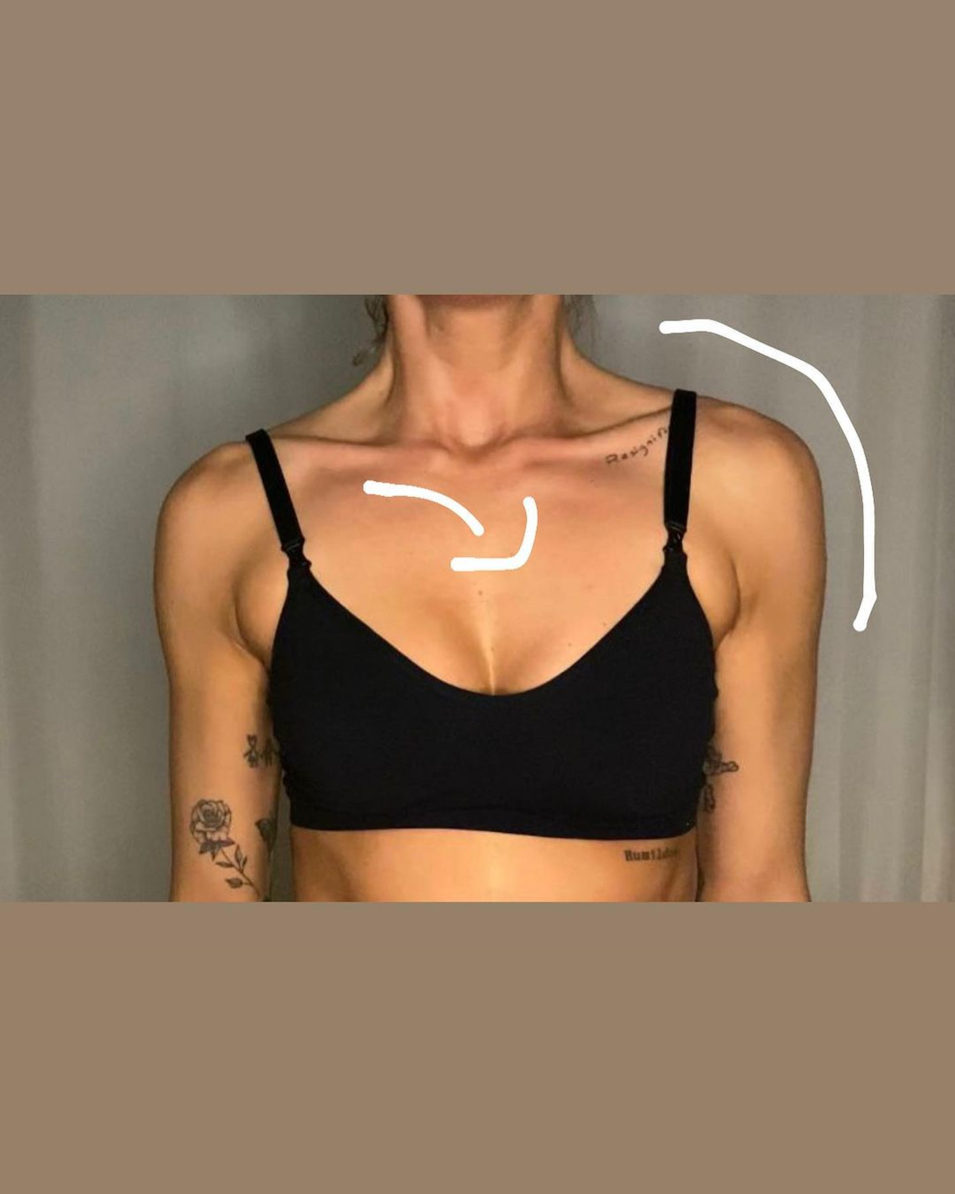 Maria Joana revela que precisou fazer nova cirurgia no seio - Reprodução