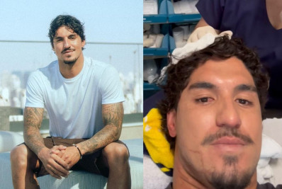 Gabriel Medina se fere durante surf e mostra machucado na cabeça
