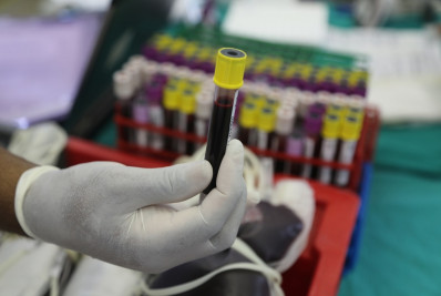 Queimados e Hemorio promovem campanha de doação de sangue