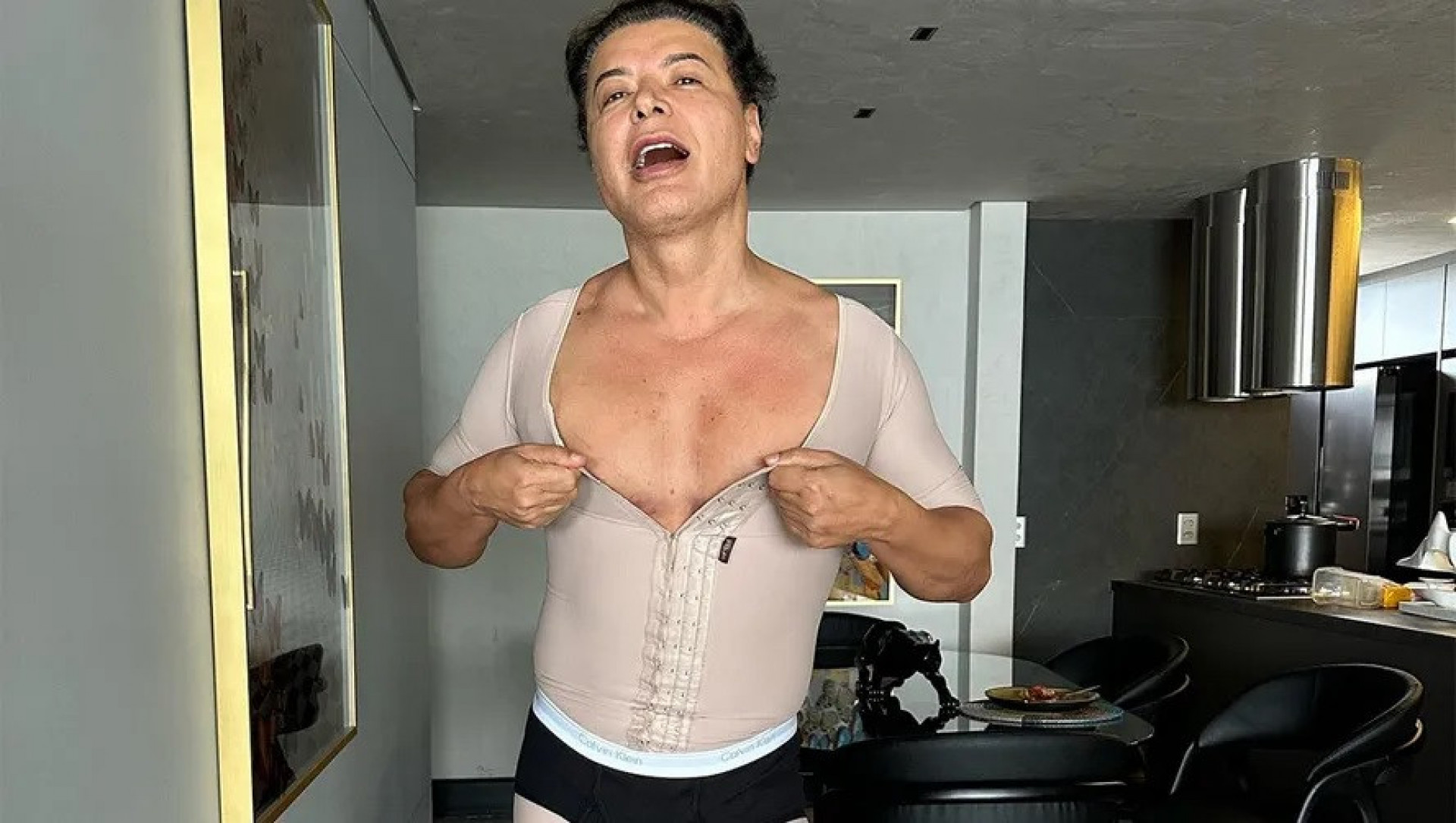 David Brazil expõe resultados um mês após lipoaspiração - Reprodução / Instagram