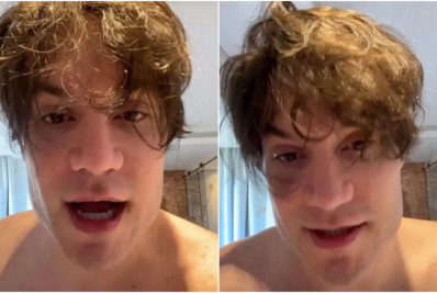 Eliezer nega ter feito novo procedimento estético: 'Deixem a minha cara em paz!'