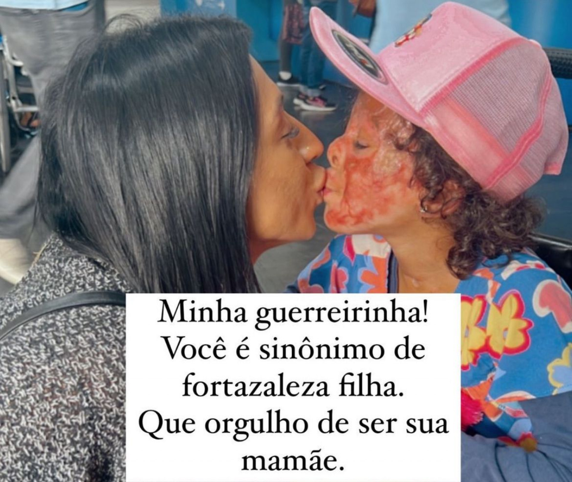 Maya Nascimento sobreviveu ap&oacute;s ter 30% do corpo queimado em um inc&ecirc;ndio no Anil - Reprodu&ccedil;&atilde;o