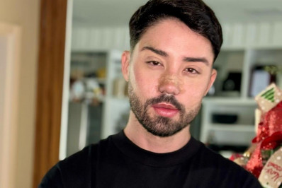 Rico Melquiades mostra resultado de cirurgia plástica no 'Domingo Espetacular'