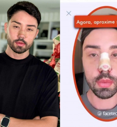 Antes e depois de Rico Melquiades: influenciador revela novo rosto