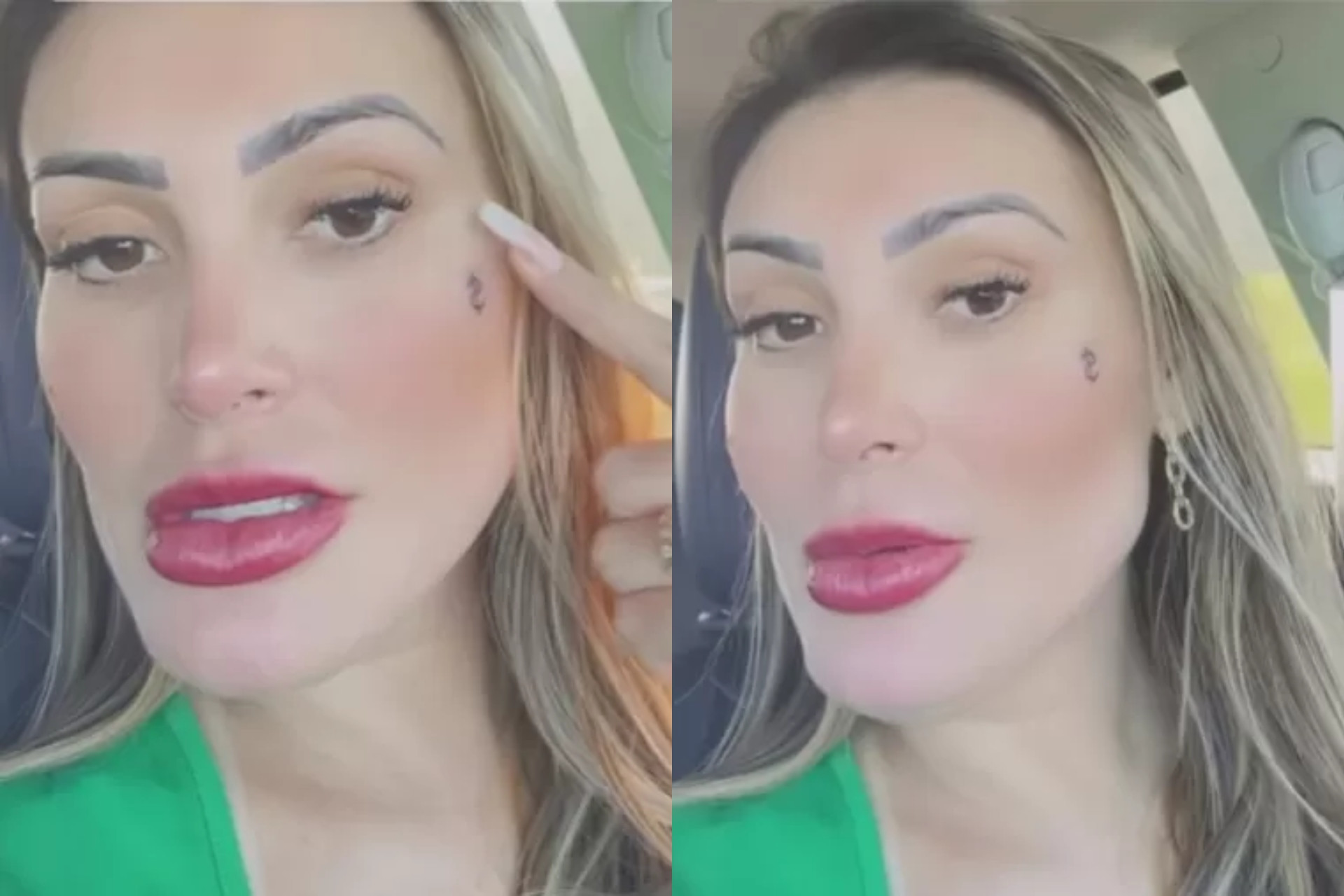 Andressa Urach tatua cifrão para cobrir mancha no rosto - Reprodução/Instagram