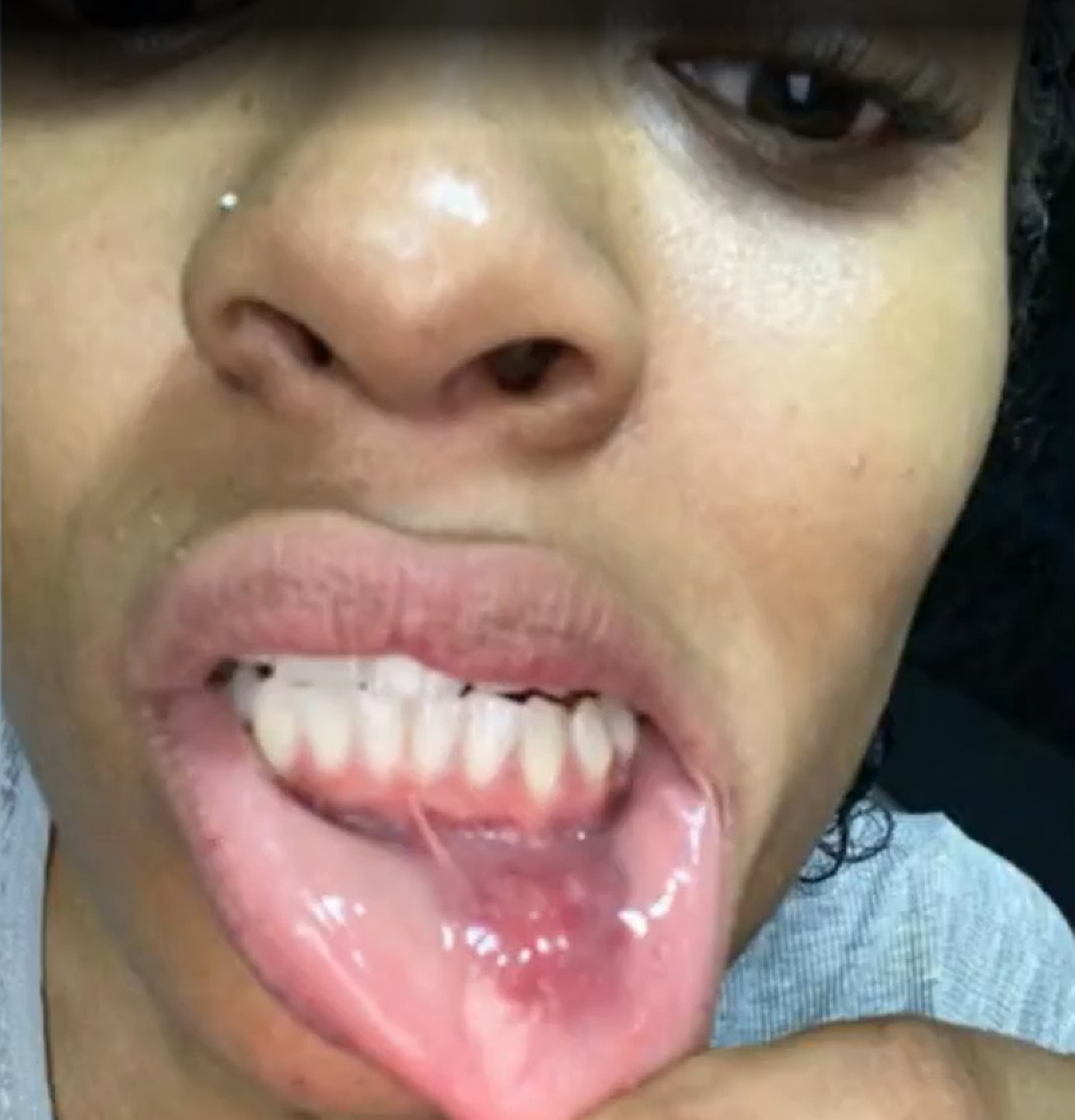 Patrícia Ramos mostra ferimentos após suposta briga com ex - Reprodução de vídeo / TV Globo