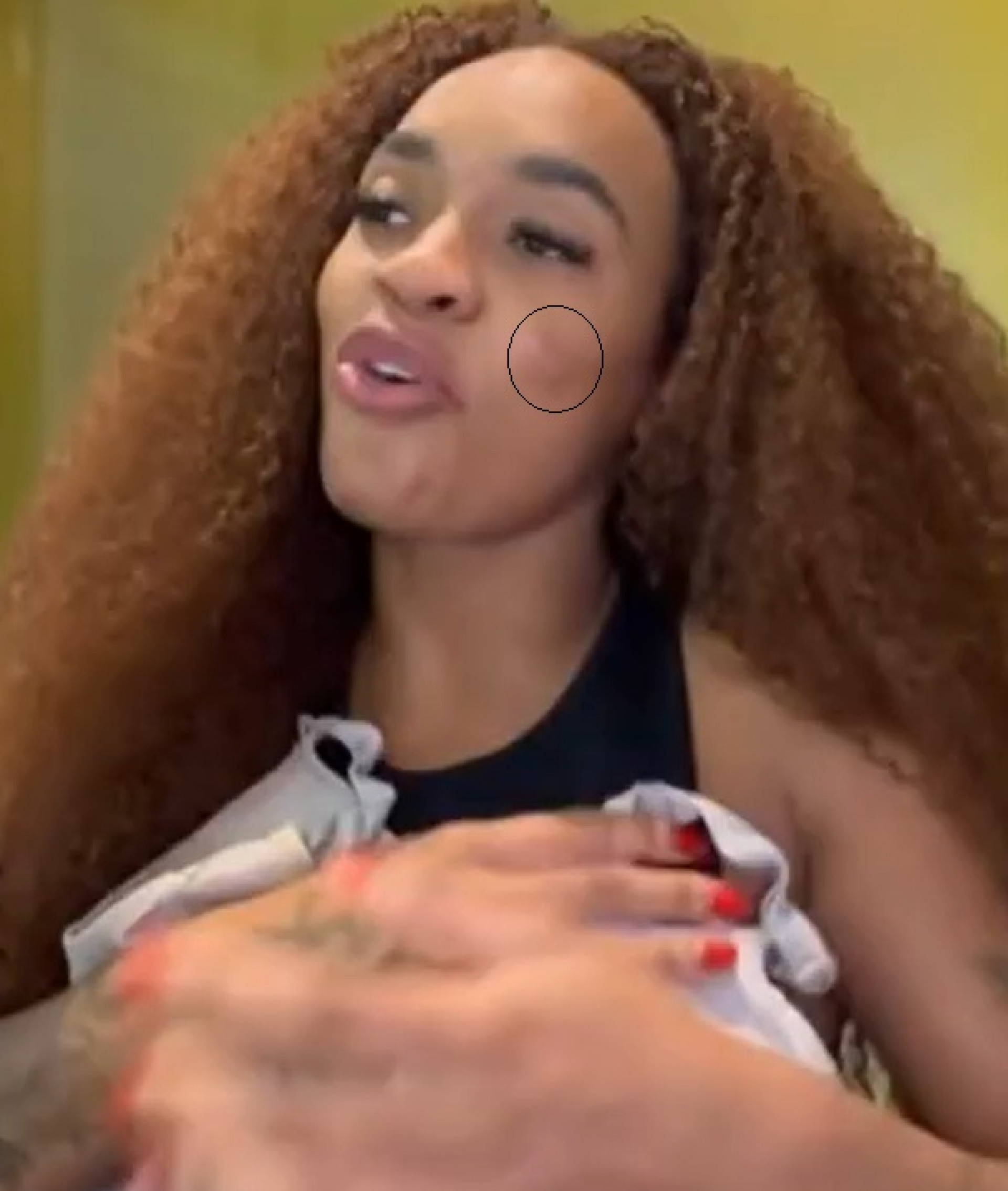 Patrícia Ramos mostra ferimentos após suposta briga com ex - Reprodução de vídeo / TV Globo