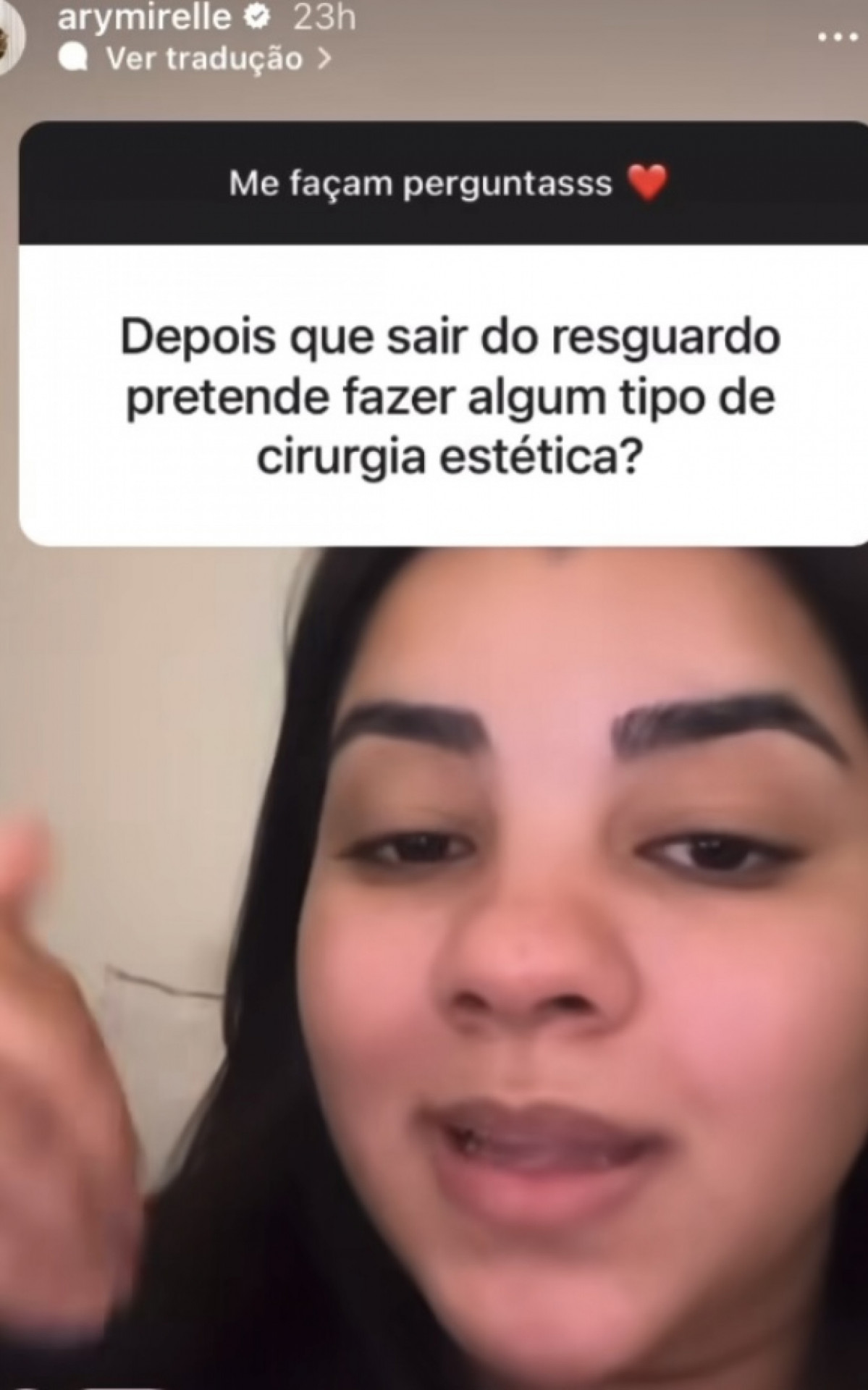 Ary Mirelle rebate seguidora sobre rinoplastia - Reprodução