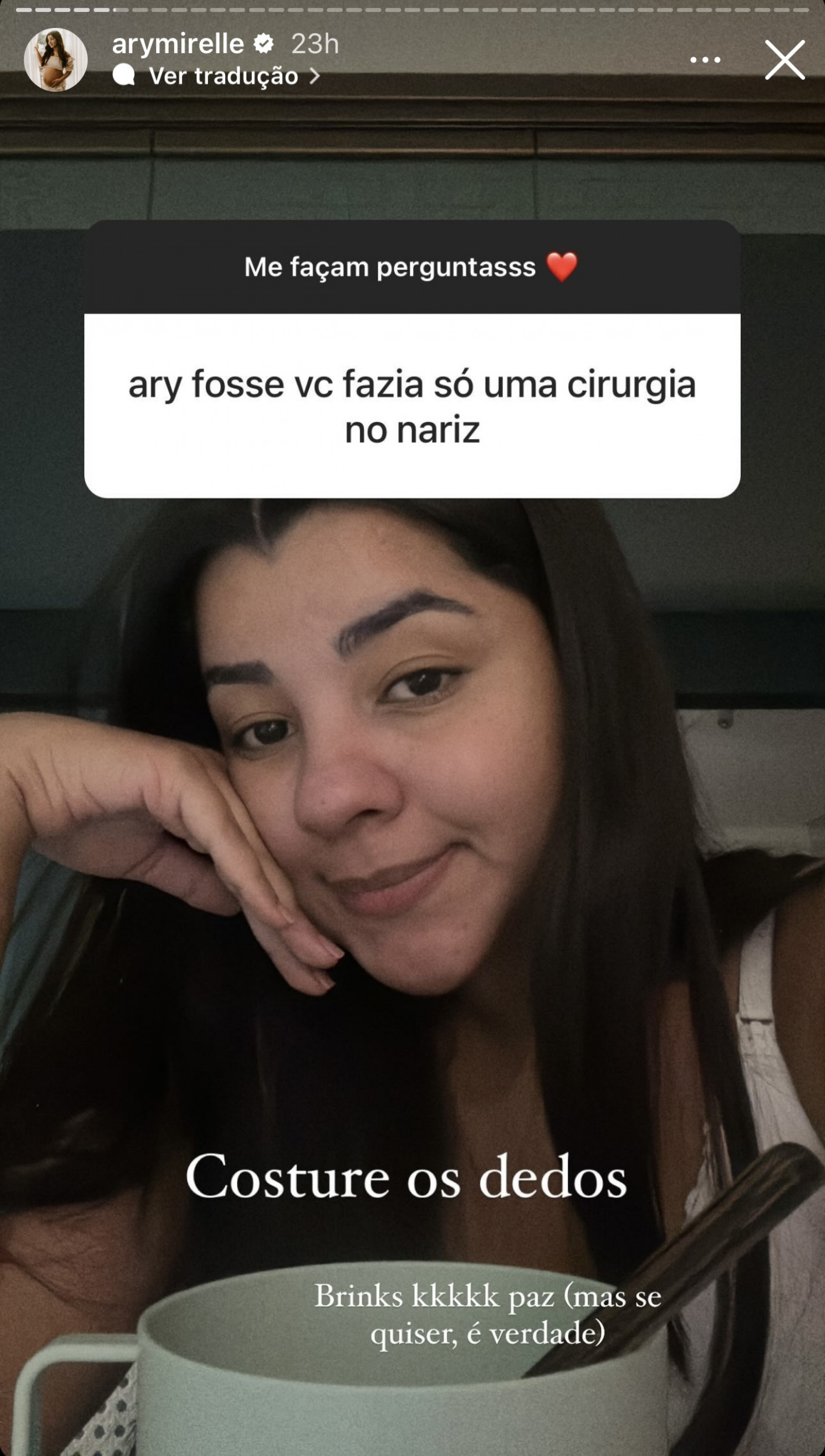 Ary Mirelle fala se faria cirurgia estética - Reprodução