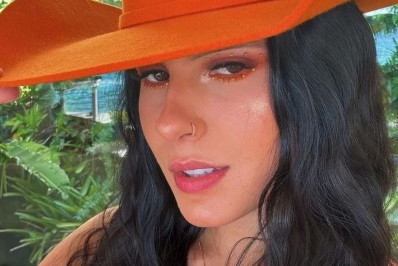 Ana Castela mostra antes e depois de procedimento estético: 'Super natural'