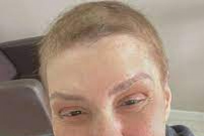 Simony: Cabelos curtos e laces são opções para quem enfrenta o câncer 