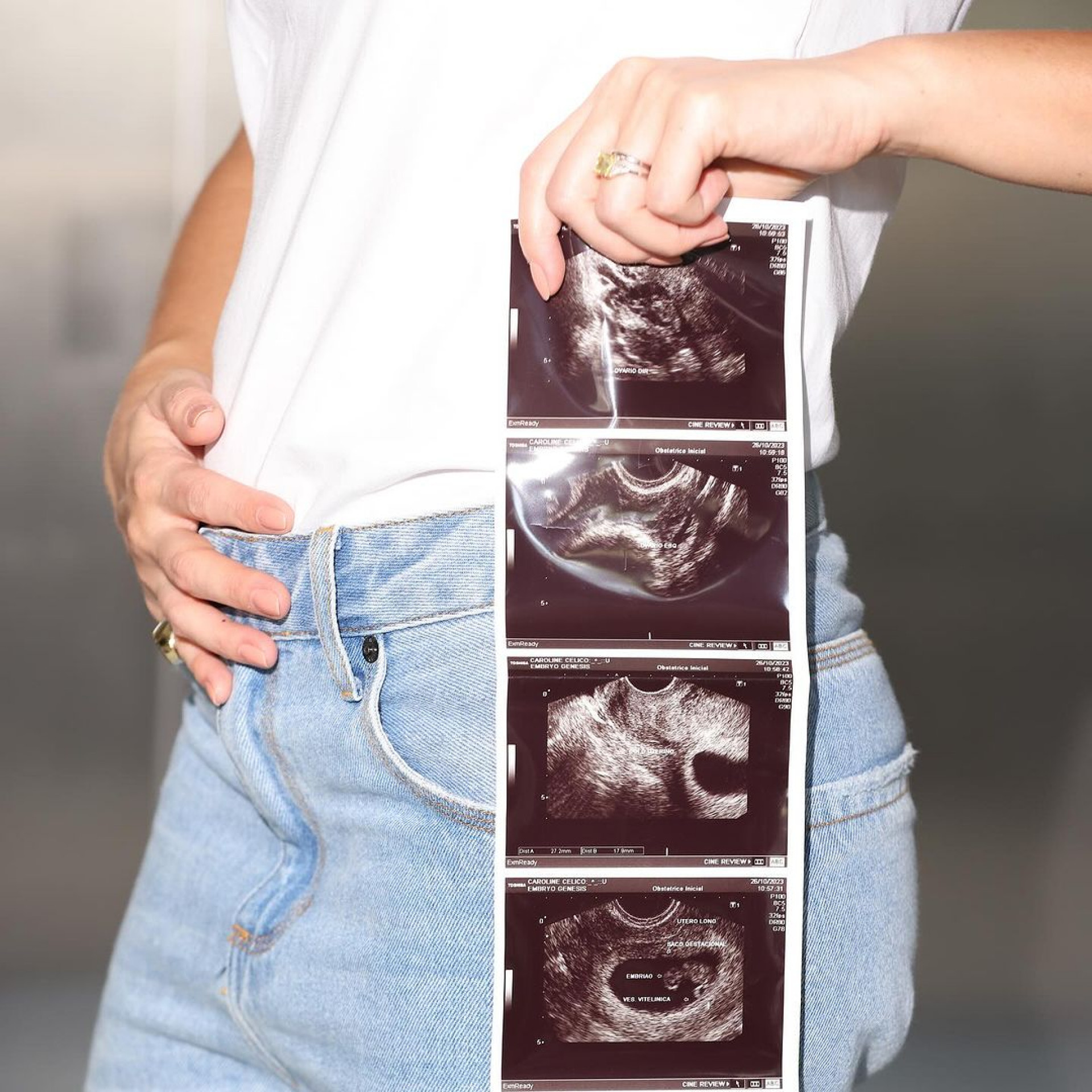 Carol Celico exibe a ultra - Reprodução / Instagram