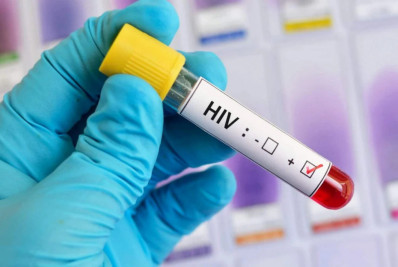 Unidades de saúde do Rio intensificam testagem de HIV