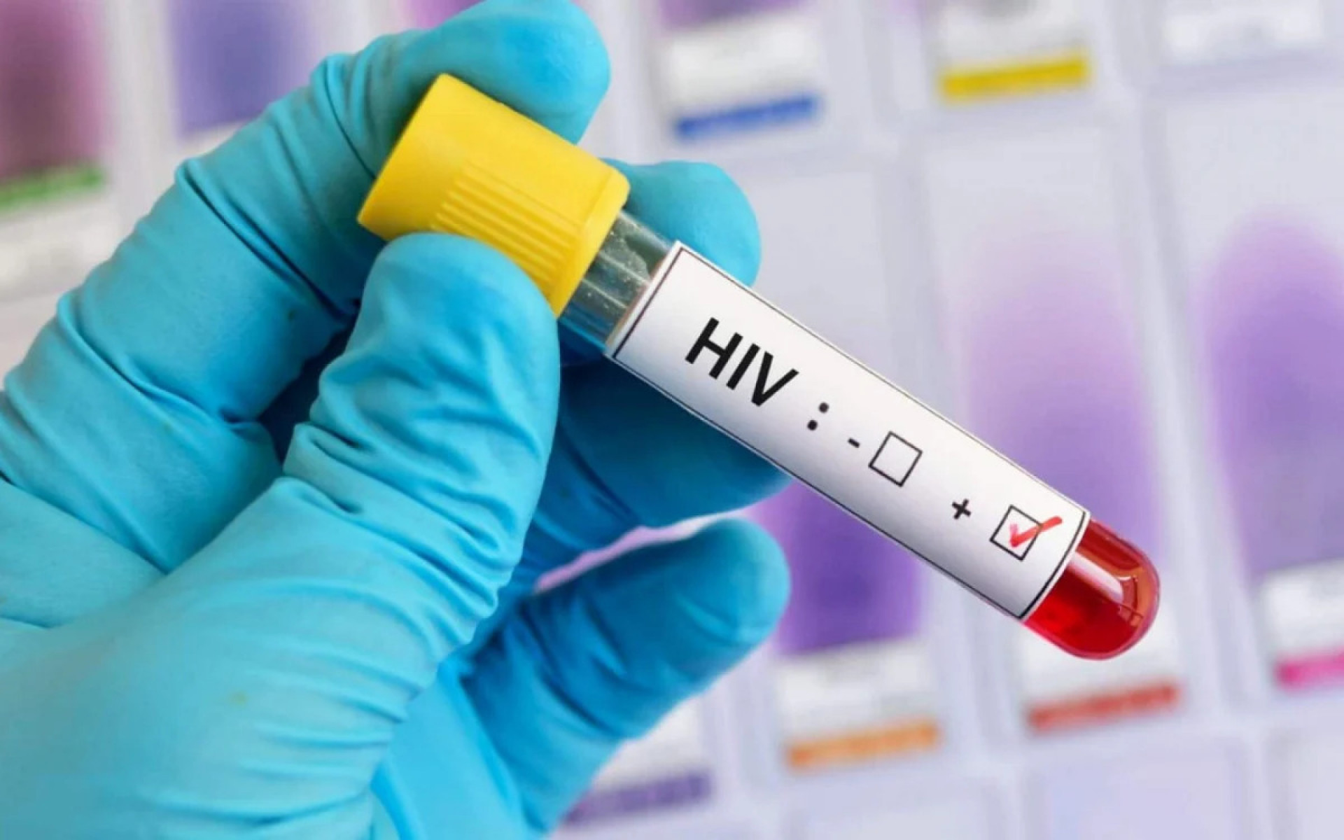ONU teme repique da aids com queda de financiamento no combate ao HIV