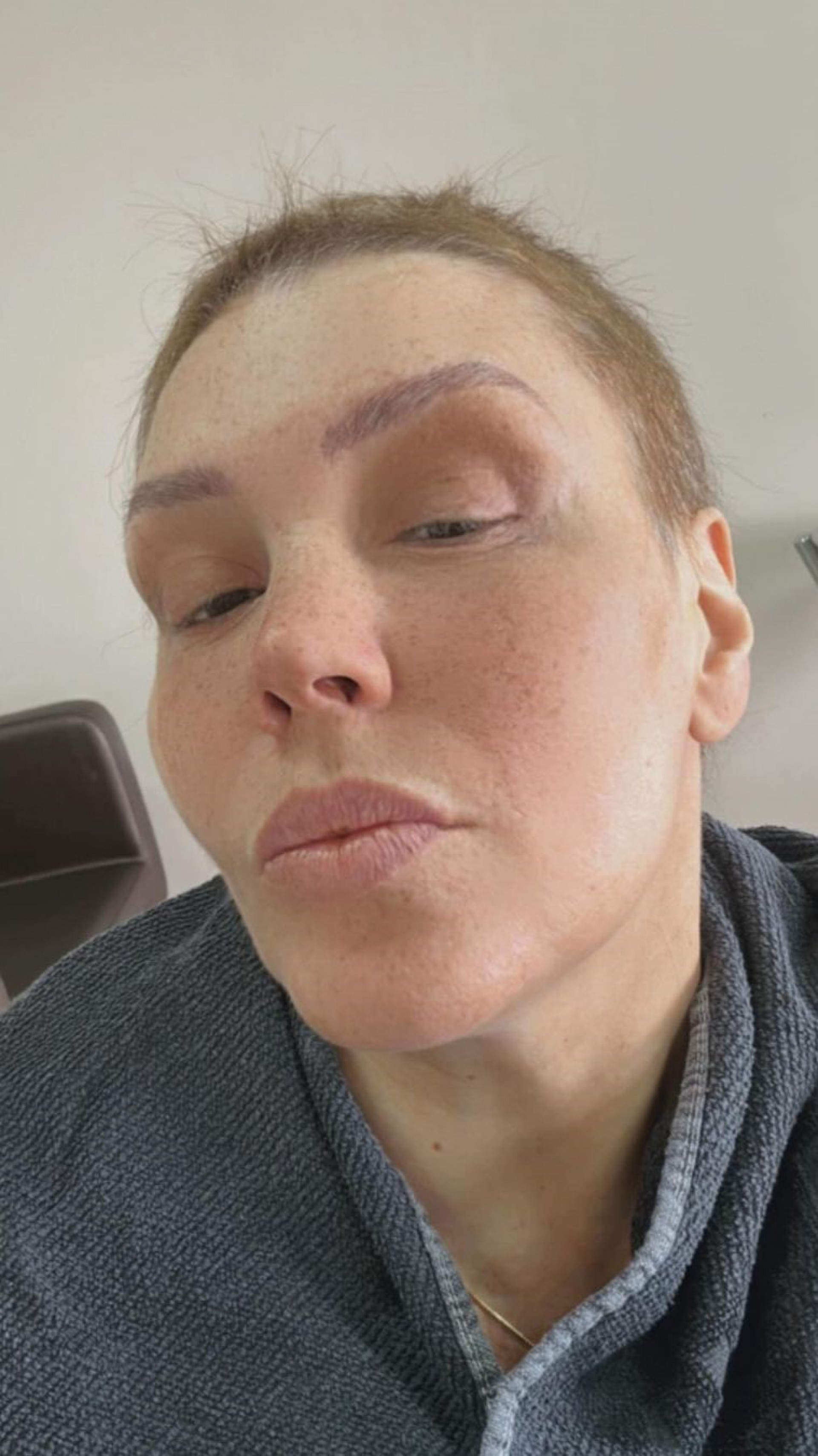 'Tem dia que realmente não estamos bem', diz Simony em meio a tratamento contra o câncer  - Reprodução / Instagram