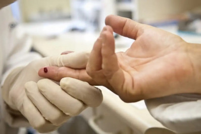 Casos de sífilis e de HIV aumentam entre homens jovens