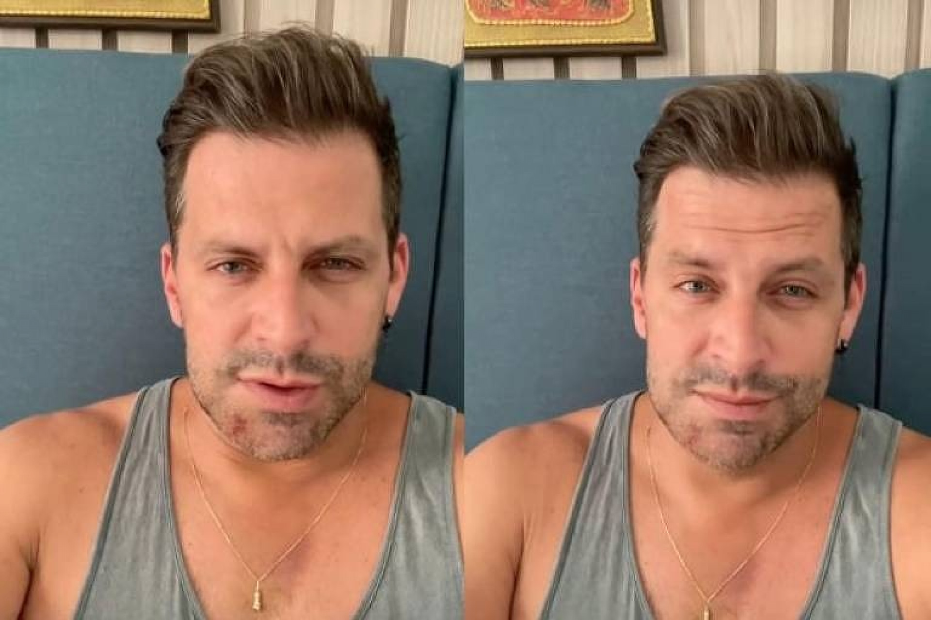 Henri Castelli mostrou fraturas de agressões após o ocorrido - Reprodução / Instagram