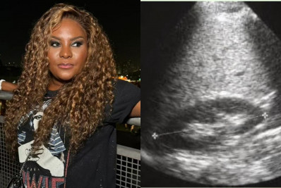 Karin Hils faz pegadinha com foto de ultrassom: 'Felicidade que não cabe dentro de nós'