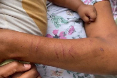 Jovem é agredida por companheiro com fio de telefone na frente da filha