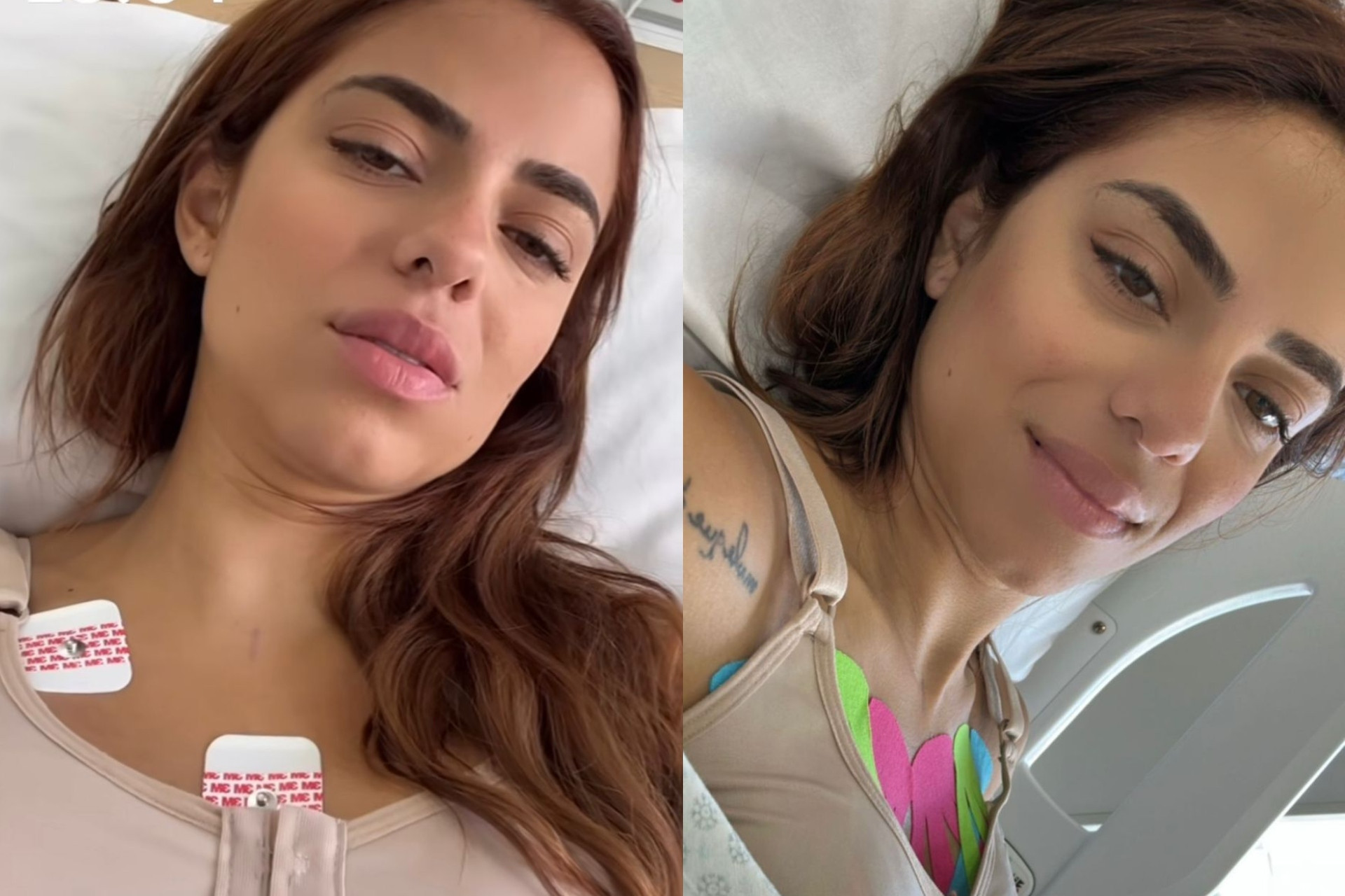 Key Alves atualiza fãs após colocar silicone  - Reprodução / Instagram 