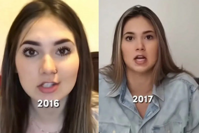 Mudanças no rosto de Virginia Fonseca viralizam na web; confira