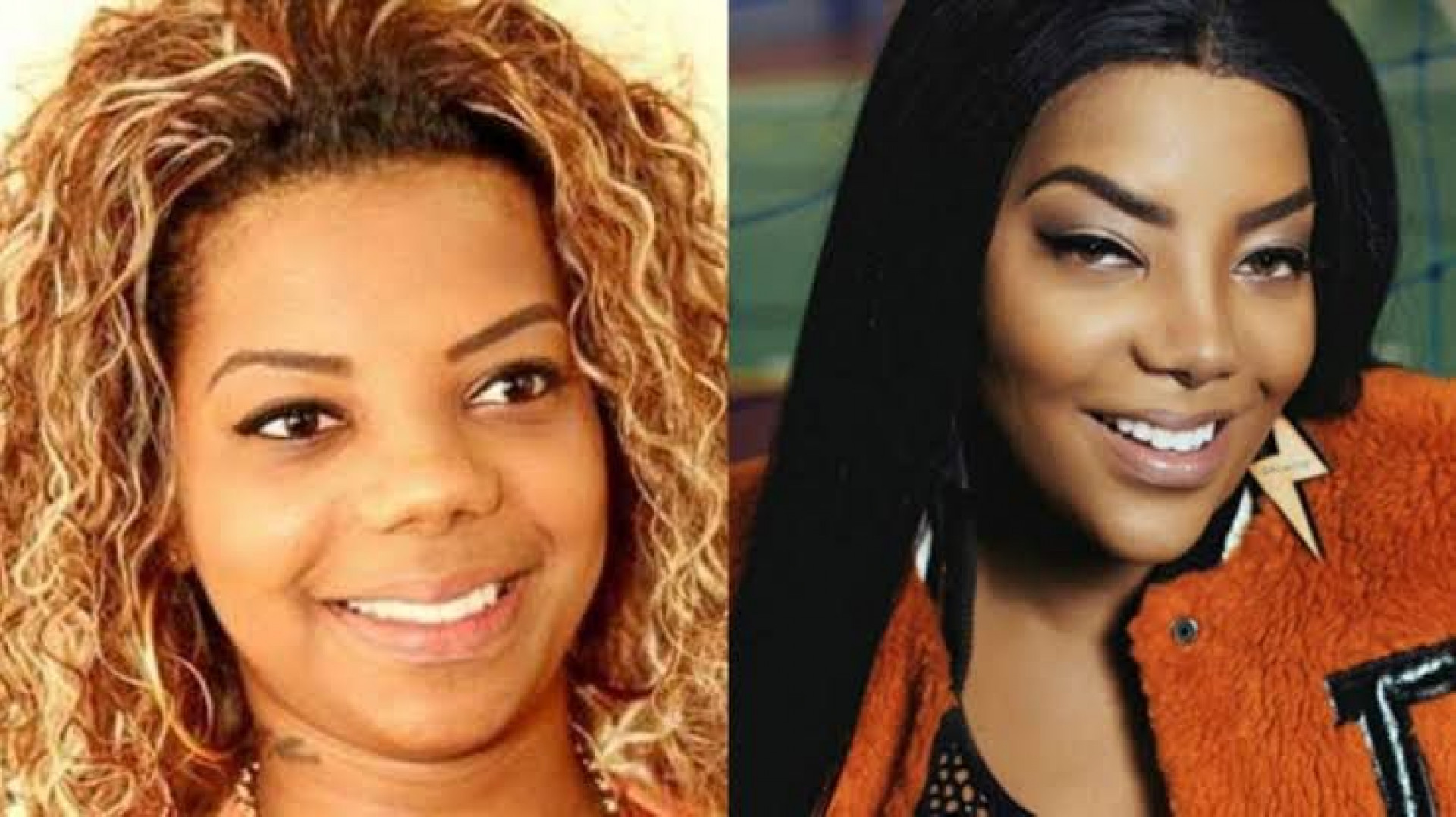 Ludmilla realizou procedimentos est&eacute;ticos no come&ccedil;o de sua carreira. Em entrevista, a cantora j&aacute; revelou que o p&uacute;blico comentava sobre sua apar&ecirc;ncia e, 'para ser aceita pela sociedade' decidiu mudar o rosto - Reprodu&ccedil;&atilde;o / Instagram