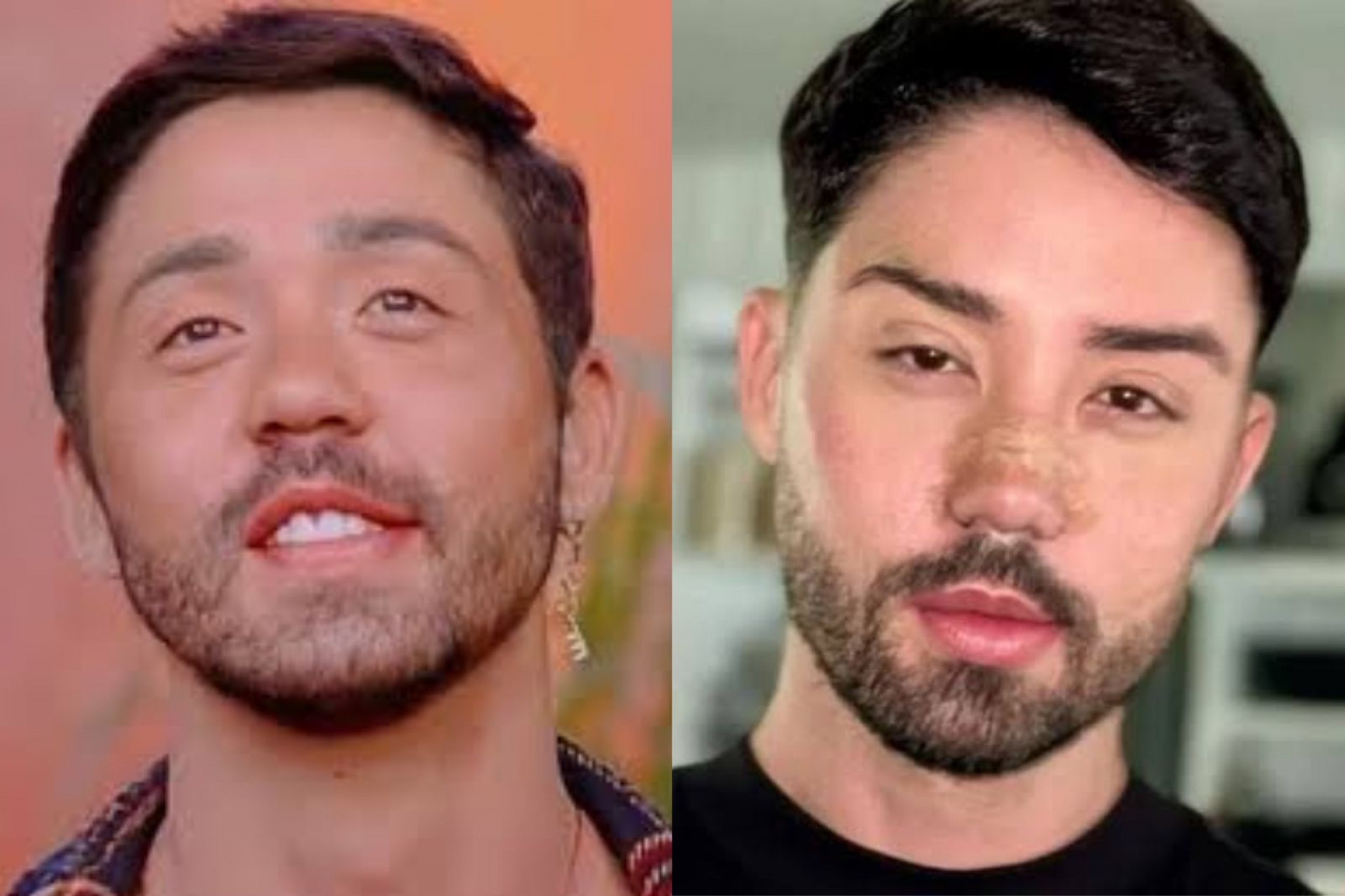 Campe&atilde;o de 'A Fazenda 13', Rico Melquiades tamb&eacute;m apostou nos procedimentos est&eacute;ticos. De acordo com famoso, a autoestima foi um dos principais fatores para a decis&atilde;o. "N&atilde;o aguentava mais ser chamado de feio", disse ele nas redes
 - Reprodu&ccedil;&atilde;o: PlayPlus / Instagram